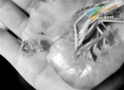 2月13日，记者从购买的“注胶虾”头部挤出胶状透明物质。新华社记者 岳月伟 摄